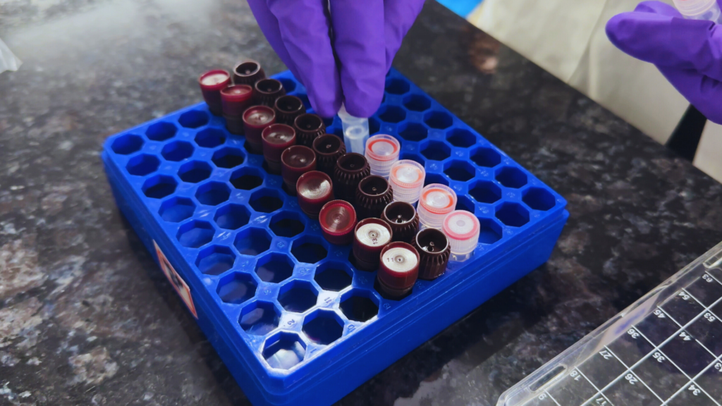 Antibodies inside ELISA Kit packaging